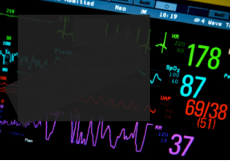 The Crashing Atrial Fibrillation Patient: Part 1