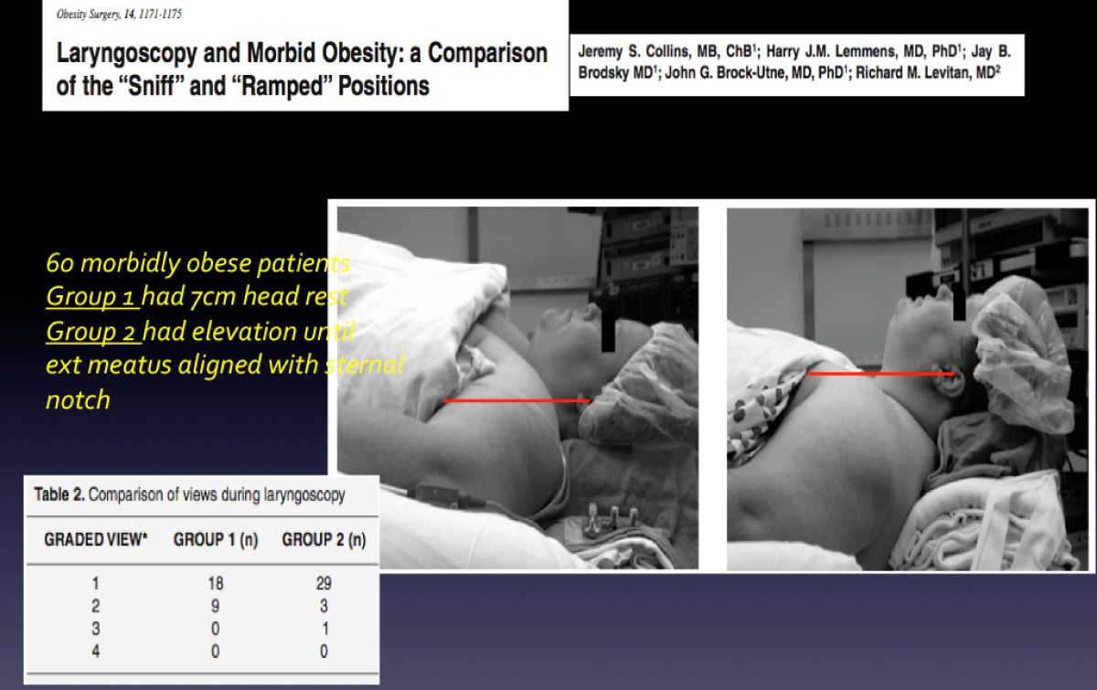 Morbid Obesity - Emergency Medicine Education - Resus