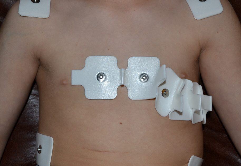 How To Read The Paediatric ECG