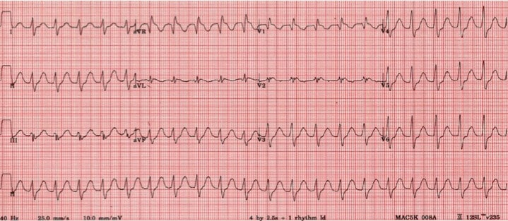 35 year old man with seizures