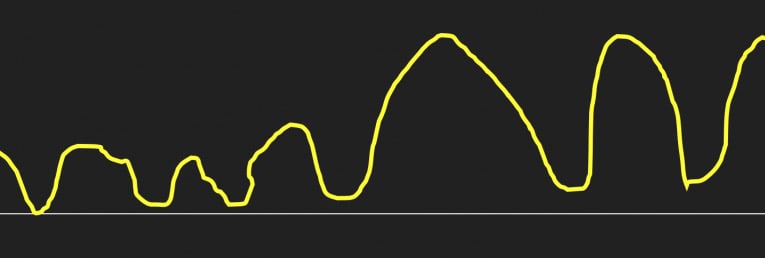 Capnography: Cardiac Arrest ROSC