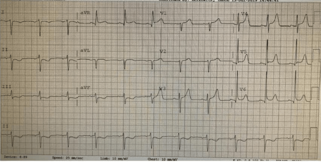 Cardiac examination