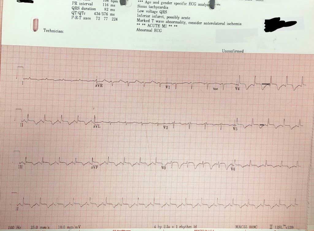 ecg-diagnosis_orig-9645304-20230813184429