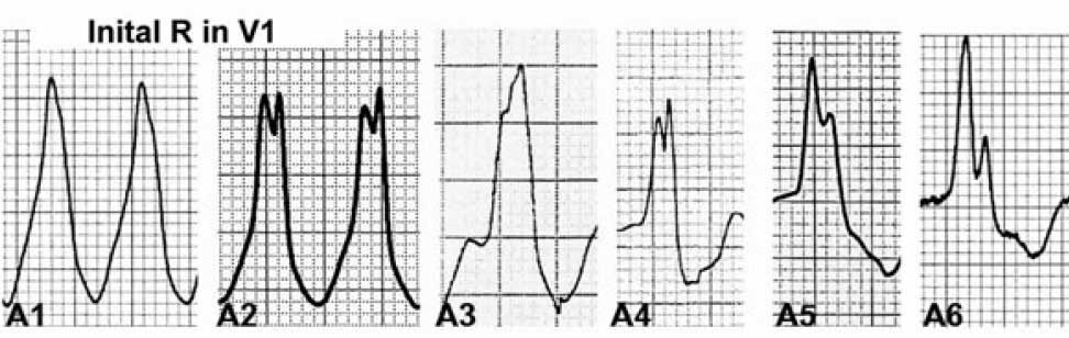 initial-r-in-v1_orig-4000174-20230813184434