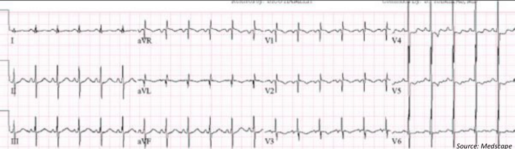 ecg-diagnosis-2_orig-6529892