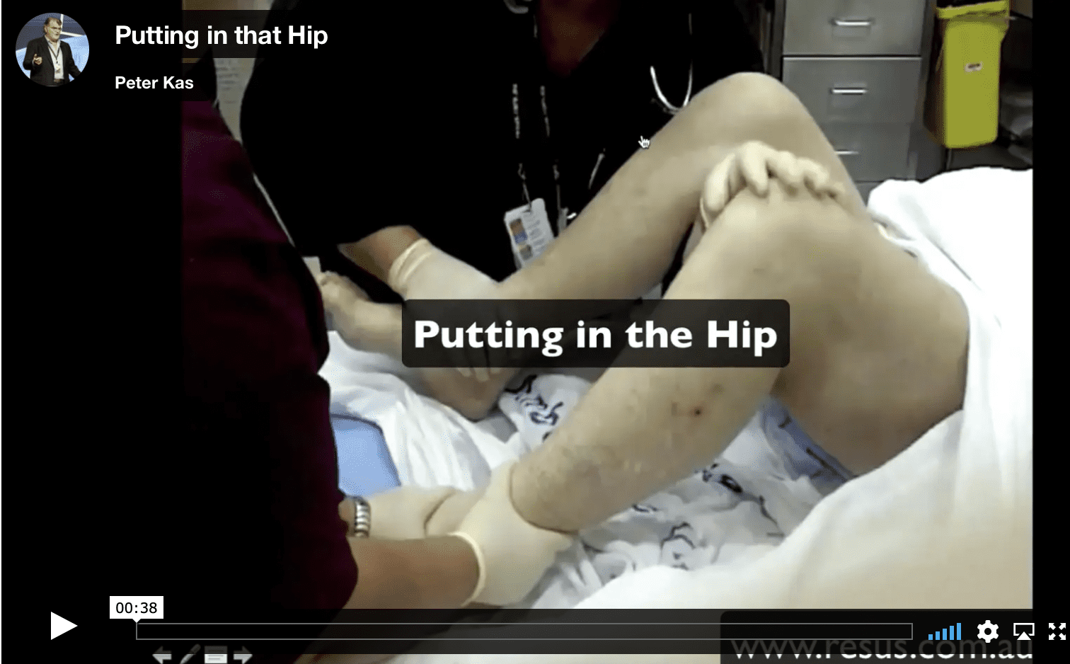 Hip Dislocation