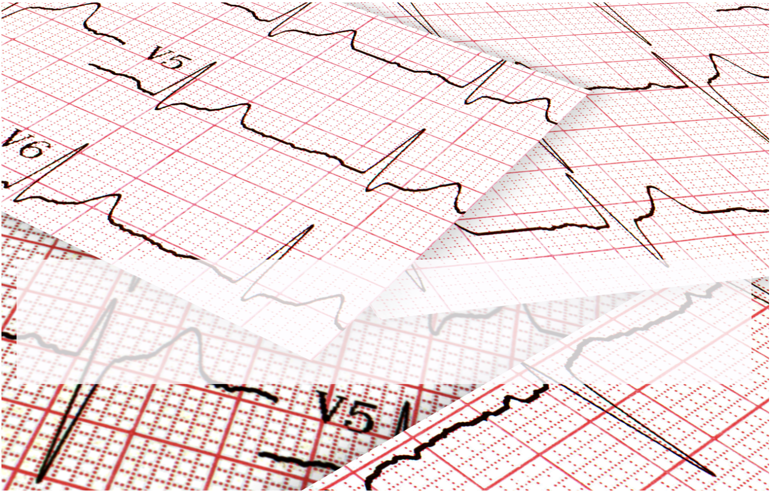 The ECG in 20 Seconds Method