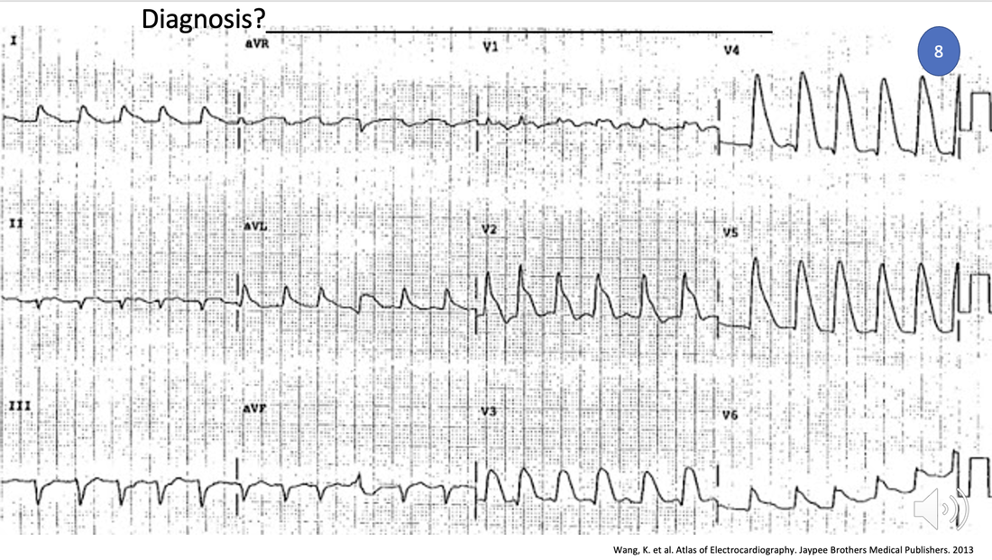 The Last ECG of the Bootcamp Quiz