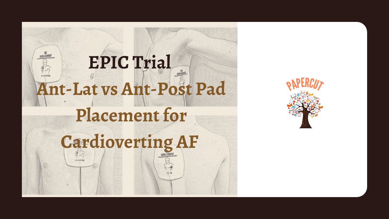 The EPIC Trial: Pad Placement for AF Cardioversion.
