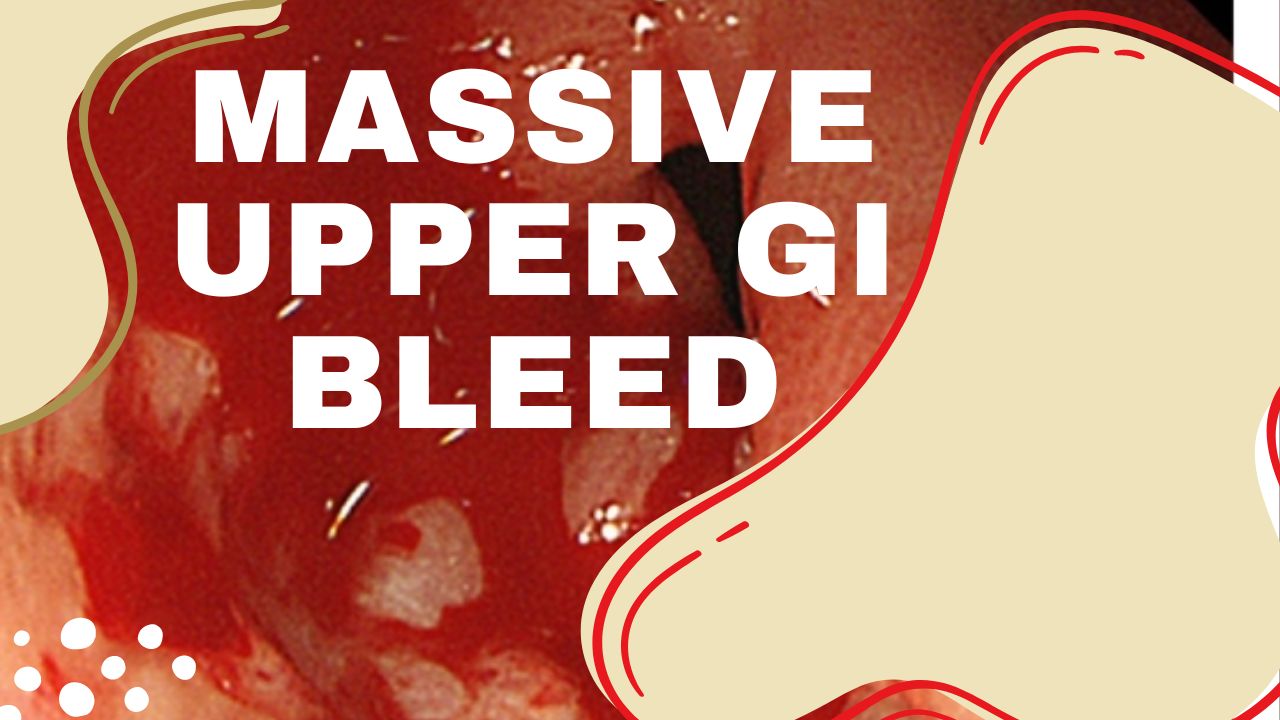 Massive Upper GI Bleed