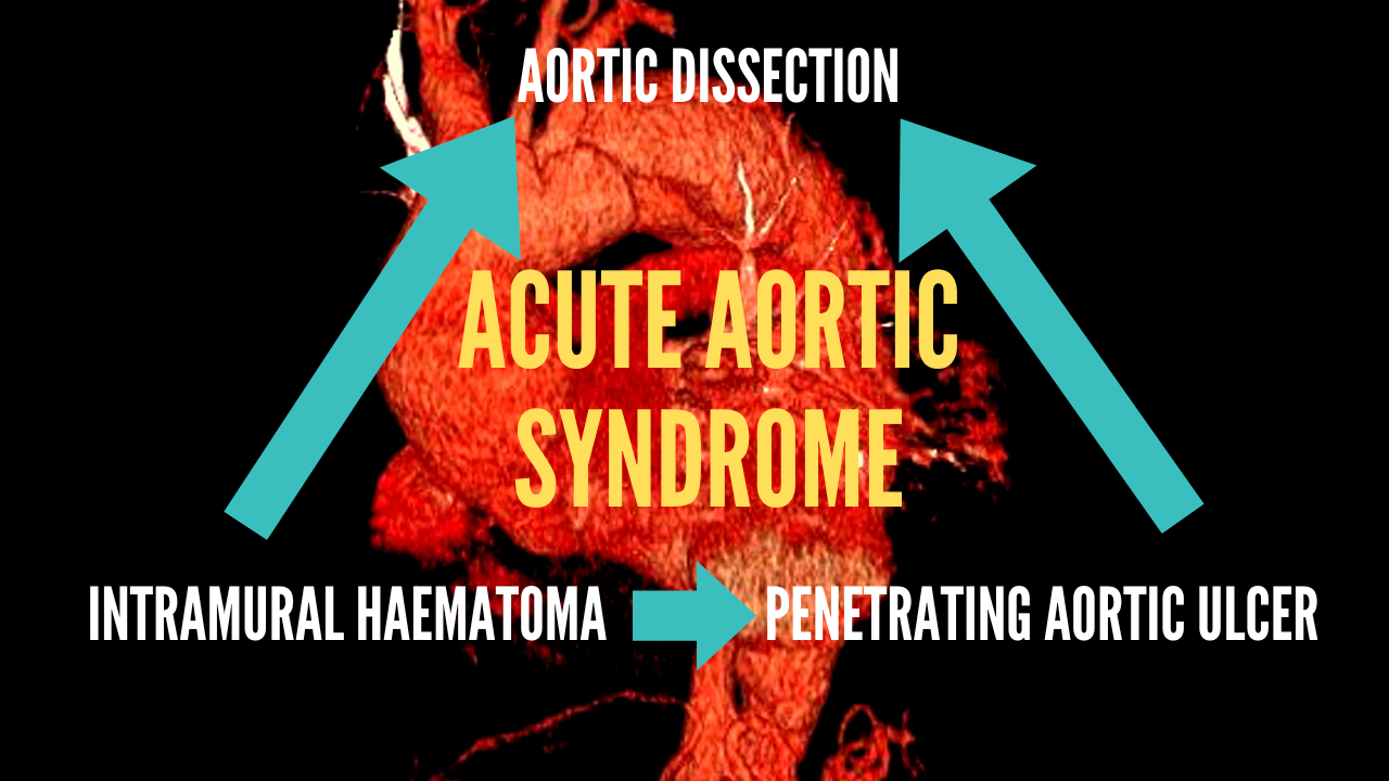 Acute Aortic Syndrome