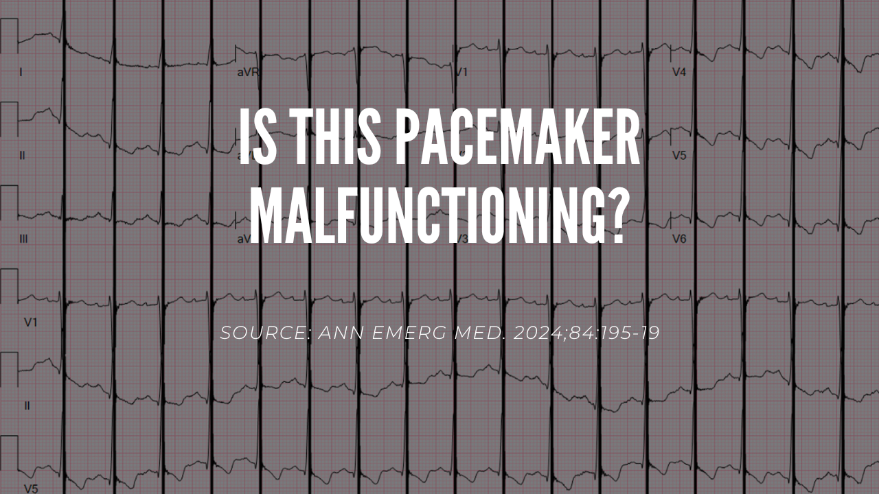 Is this a pacemaker malfunction?